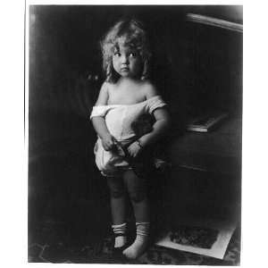  Little girl, sunsuit slipping off her shoulders,c1916 