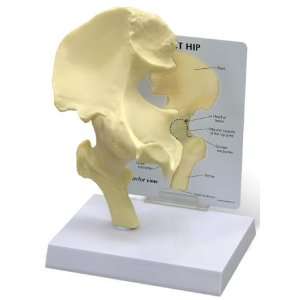 Human Hip Joint Anatomy/Anatomical Model #1260  Industrial 